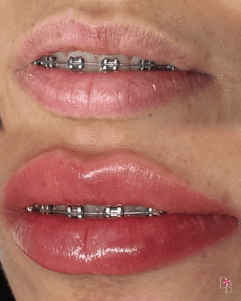 Lip Blushing Toronto and Lip Blush Richmond Hill Before After