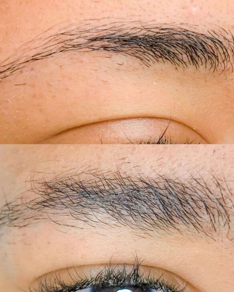 daphne beauty brow repair before after v1