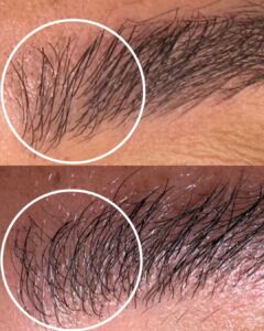 daphne beauty brow repair before after v3