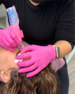 daphne beauty lash line before after v1