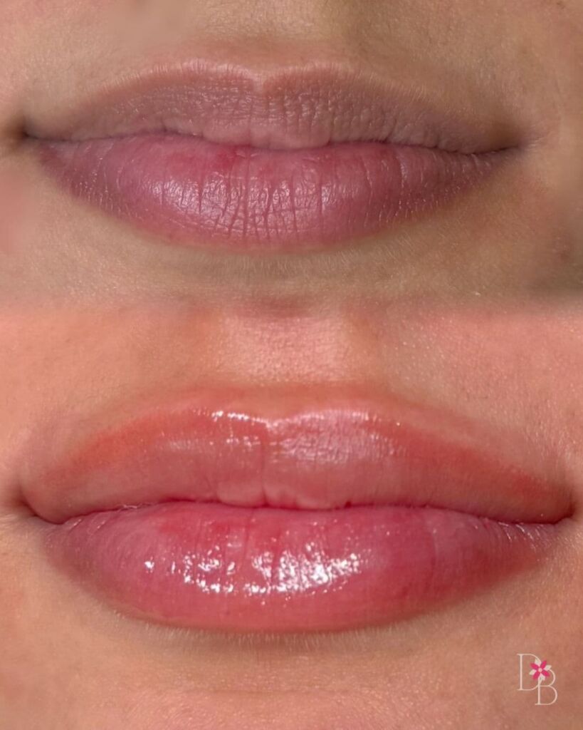 daphne beauty lip blushing before after v2