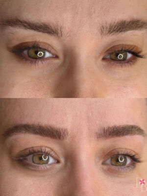 Nanoblading Before After Nanoblading Before After